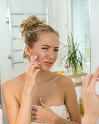 Una mirada al interior del acné