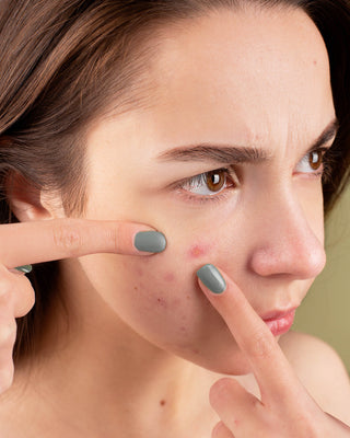 Cómo cuidar la piel grasa