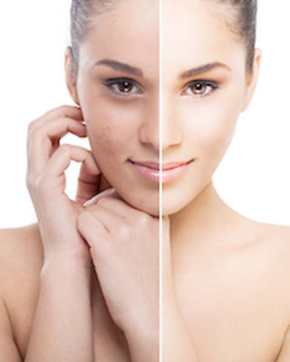 ¿Qué tipo de pigmentación hay en la piel?